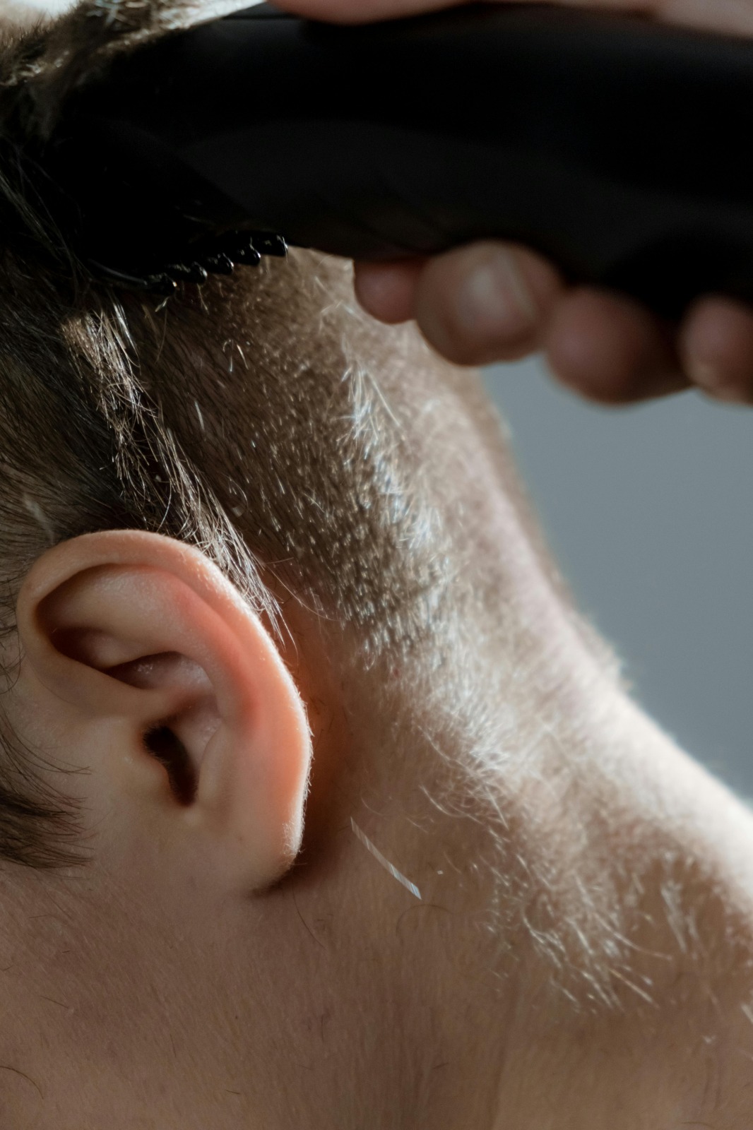 Hair Transplant